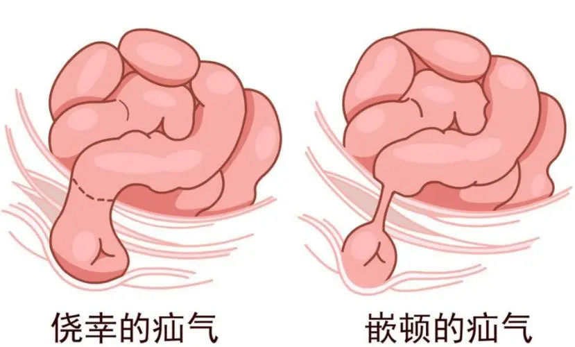 u=2385618497,925006729&fm=253&fmt=auto&app=138&f=JPEG_副本.jpg